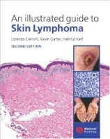 An Illustrated Guide to Skin Lymphoma артикул 13991d.
